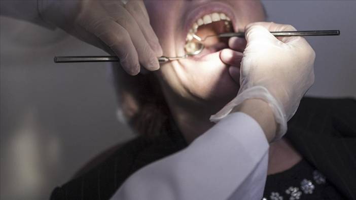 Eksik dişi olanlar dikkat! Prof. Dr. Özkan bilinmeyen gerçekleri açıkladı: Bu hastalıklara davetiye çıkarıyor