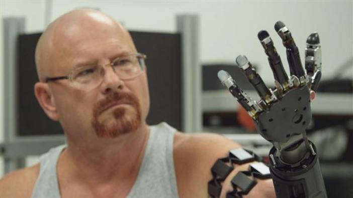 Robotik uzuvlarla gelecek: Beyin kontrollü sağlık yenilikleri