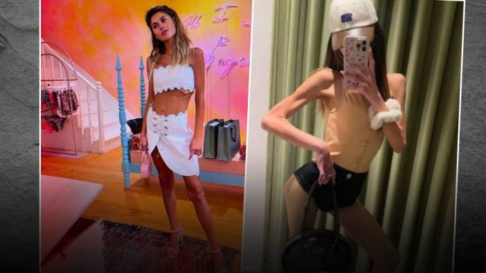 25 kiloya düşmüştü: Nihal Candan yeniden yoğun bakımda!