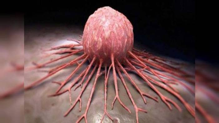 Kanser tedavisinde çığır açacak gelişme. Bu hastalıktan artık kimse ölmeyecek. İnsanlar üzerinde denenmeye başladı