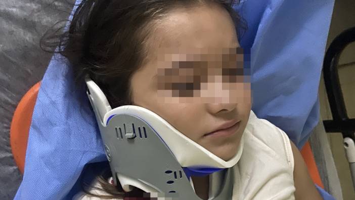 Ordu'da ters şeritten gelen scooter, 8 yaşındaki çocuğa çarptı