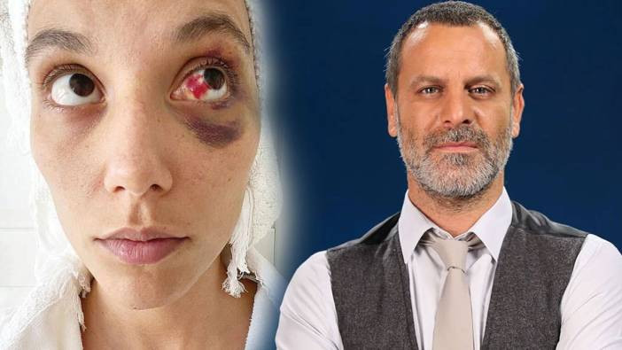 Taciz ifşaları sürerken topa tutulmuştu! Ozan Güven projeden apar topar ayrıldı