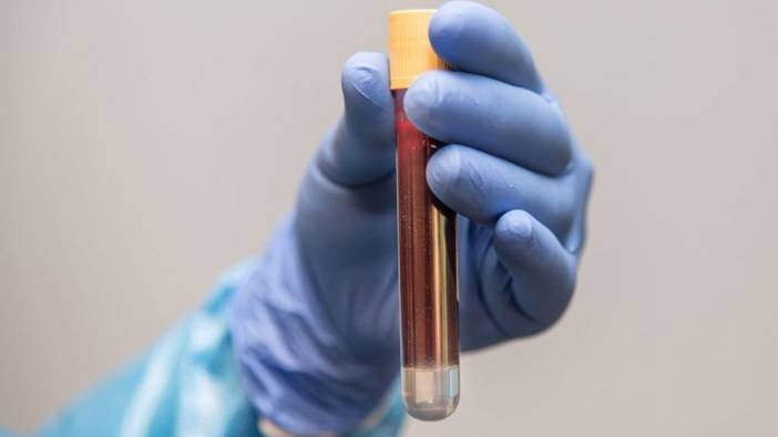 'Sessiz katil' için önemli uyarılar: Erken tanıyla hayatta kalın!