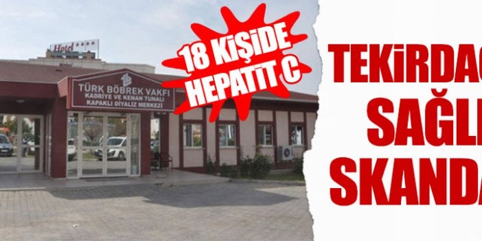 Tekirdağ'da 18 hastada Hepatit-C tespit edildi