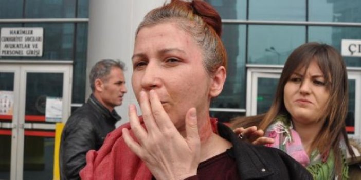 Yüzüne yanıcı madde atılan kadın: "Koruma talebim reddedildi"