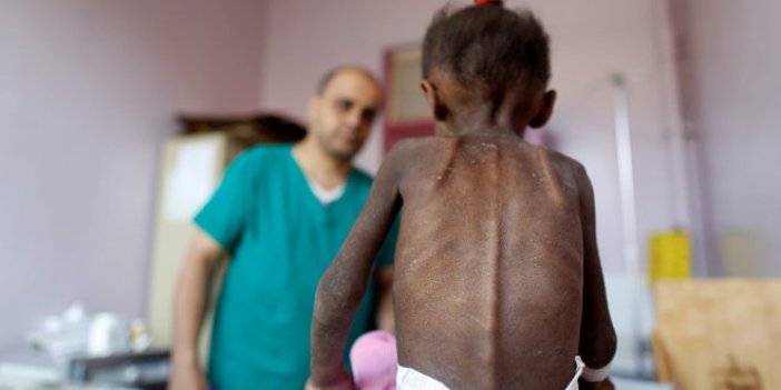 Yemen'de 85 bin çocuk açlıktan öldü!