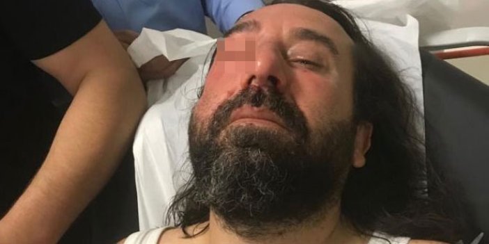 İYİ Parti kurucularından Metin Bozkurt'a saldırı