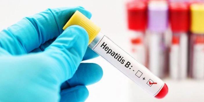 Hepatit hastalarının sadece yüzde 1'i tedavi oldu