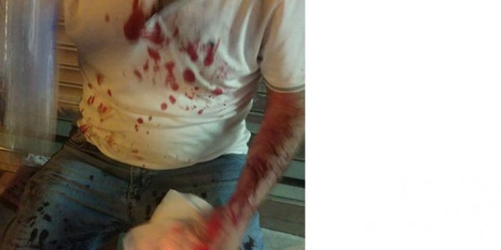 İmamoğlu'na destek vereceğini söyleyen bir İYİ Partili daha saldırıya uğradı!