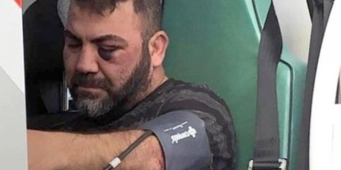 Alman polisi Türk vatandaşını hastanelik etti