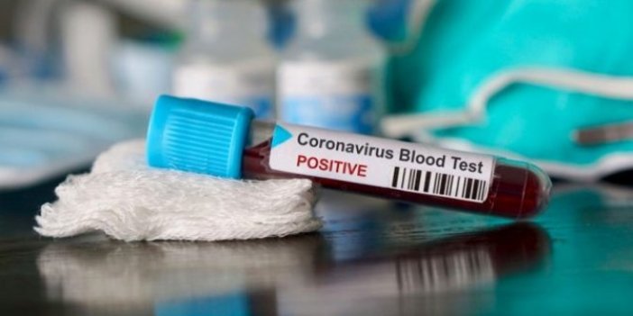 İtalya'da corona virüs vakası artıyor