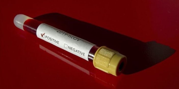 Rusya'da 4 corona virüs vakası daha