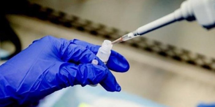 Salih Cenap Çevli: “Testi negatif çıkan Korona virüs hastaları var”