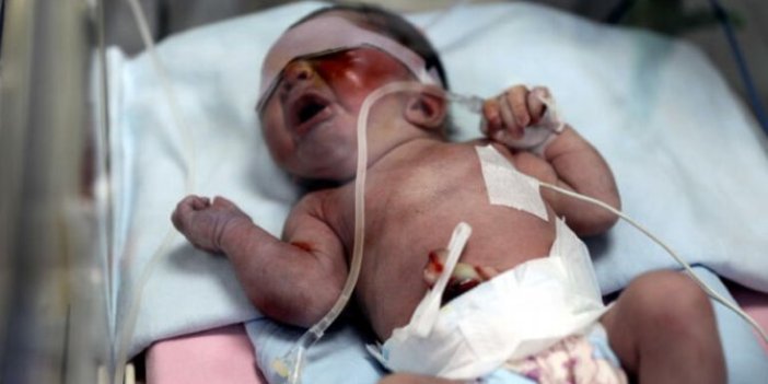 Vicdansızlar! Bu bebek daha 1 günlük