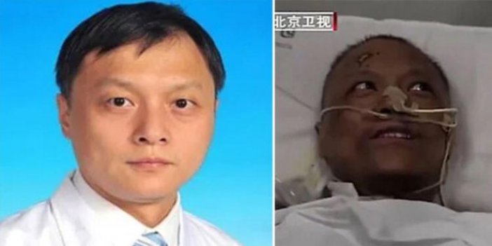 Rengi değişen Çinli doktordan acı haber
