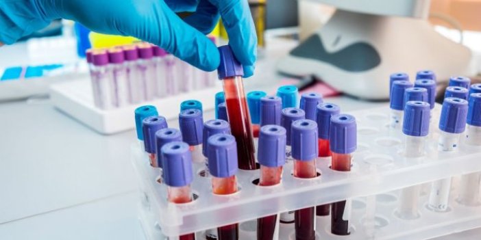 Araştırmalar sonuçlandı: İşte virüste daha riskli olan kan grupları