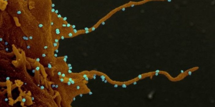 Korona virüs hakkında şok görüntüler ortaya çıktı: Kollarını açıp, diğer hücrelere saldırıyor