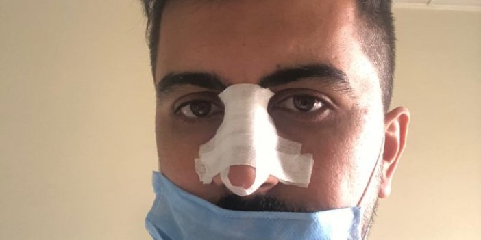 Hasta yakını, sosyal mesafe uyarısı yapan hemşirenin burnunu kırdı
