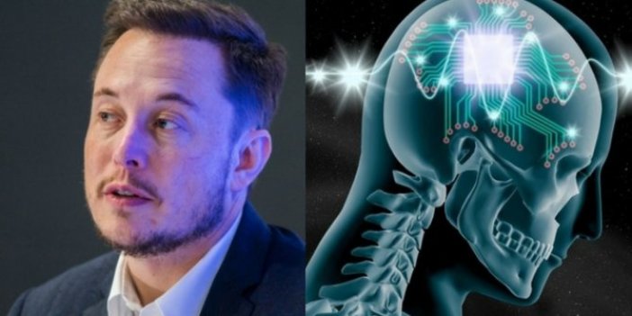 NeuraLink nedir?