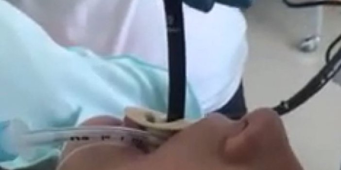 Uyuyan kadının ağzına 1 metrelik zehirli yılan girdi! Ameliyat anı kamerada! Şaka değil gerçek