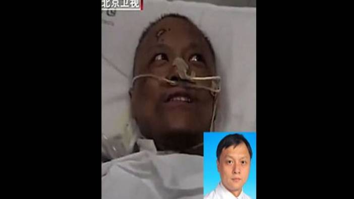 Korona virüs ten rengini değiştirmişti. İşte virüsü atlatan Çinli doktor Yi Fan'ın son görüntüsü