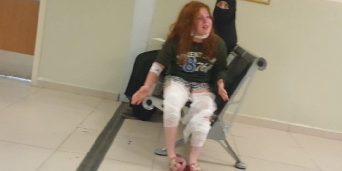 Bursa'da üzerine çay dökülen Eda tedaviye alındı