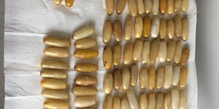 Tam tamına 93 kapsül midesinden çıktı