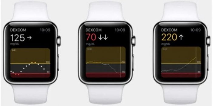 Apple Watch Series 7 Kan Şekeri ölçebilecek