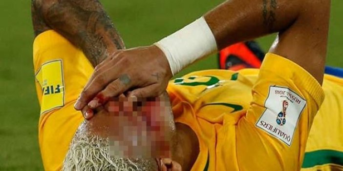 Neymar maçta kanlar içinde kaldı