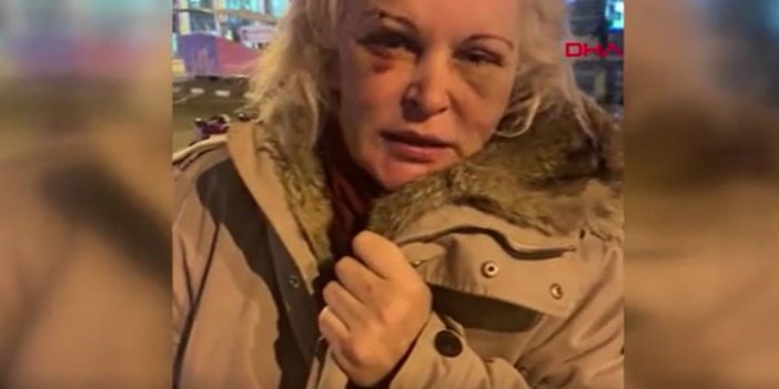 Otel odasında öldüresiye dövülen Rus Otteva Elvira gönderdiği videoyla her şeyi anlattı