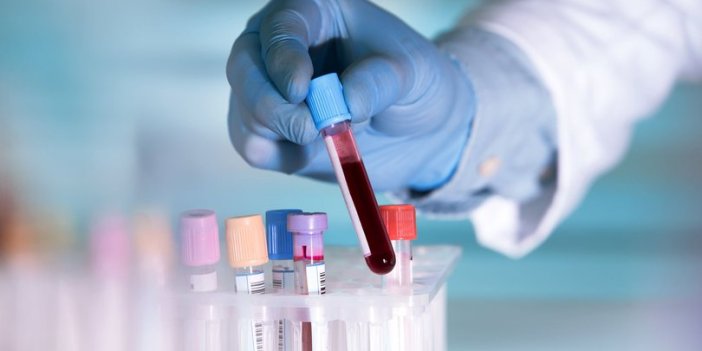 Bilim insanları, 50 kanser türünü doğru tespit eden kan testinin analizini yaptı