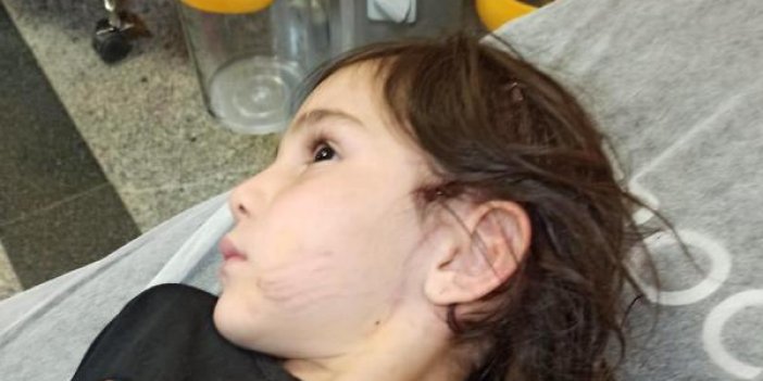 Dinar'da sevdiği köpek 6 yaşındaki kıza dehşeti yaşattı