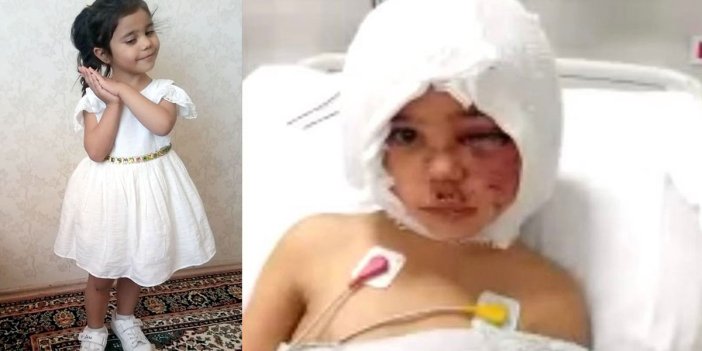 Pitbullar saldırdığı 4 yaşındaki Asiye’nin sağlık durumu hakkında yeni gelişme