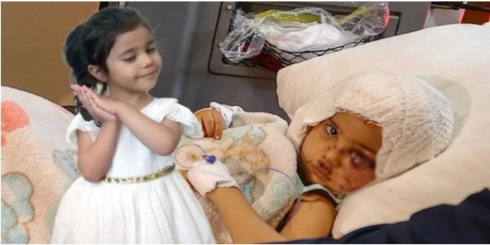 2 pitbullun saldırısında yaralanan 4 yaşındaki Asiye Ateş'e yüz siniri için yama ameliyatı yapılacak
