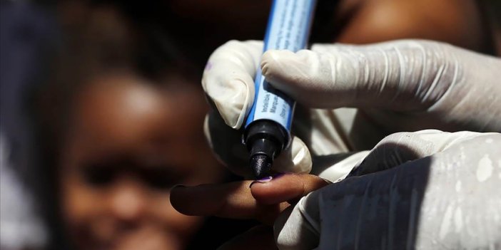Nijerya'da çocuk felci virüsü yeniden ortaya çıktı