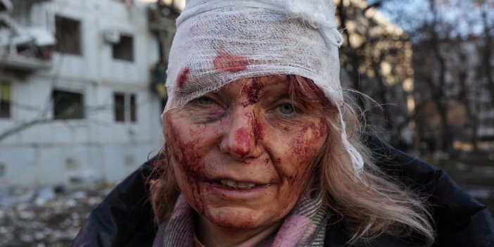 Helal olsun Anadolu Ajansı'nın savaş muhabirlerine! Ukrayna'da yaşananları bu iki fotoğrafla dünyaya duyurdular