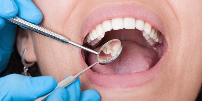 Diş çürüklerini önlemek için tavsiyeler
