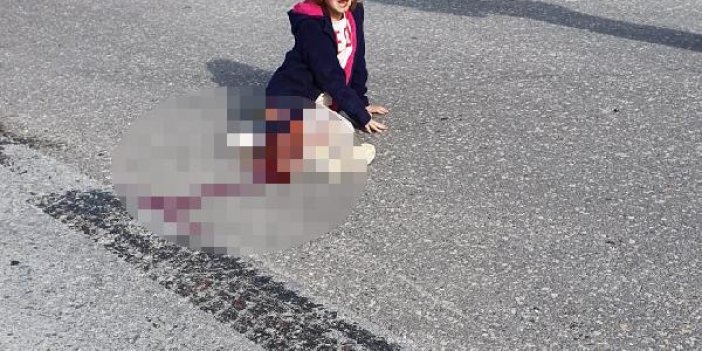 Sokak köpeklerinden kaçarken kamyon altında kaldı, bacağı kesildi. Sokak köpeklerini savunanlar bu kızın bacağını kim geri getirecek