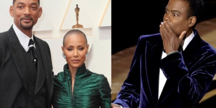 Jada Pinkett Smith, hastalığını anlatırken şöyle demişti: ''Avucum saçlarımla doldu''