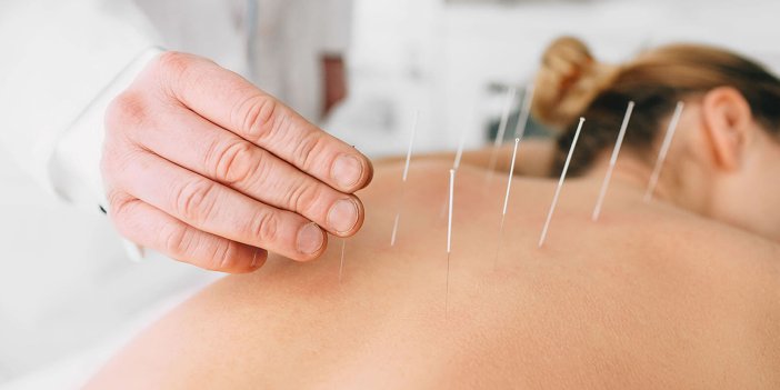 Akupunktur birçok sağlık sorununu çözüyor!