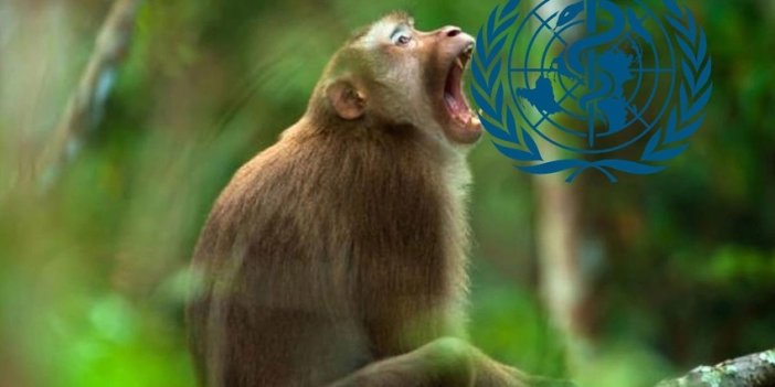 Dünya Sağlık Örgütü, maymun çiçeği virüsü için acil toplanıyor
