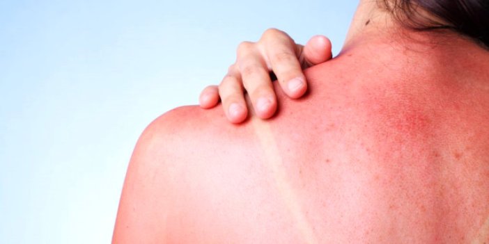 Güneşin cilde verdiği hasarı tersine çevirmek mümkün mü?