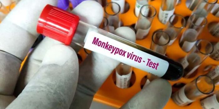 Maymun Çiçeği virüsü ile ilgili kritik uyarı