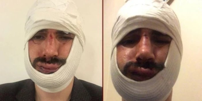 Anadolu Ajansı muhabirine saldıran iki sanığa hapis cezası