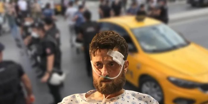 Ünlü oyuncu Hakan Yufkacıgil'e kısa mesafe dayağı! Taksici burnunu kırdı