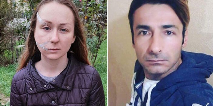 11 yıl hapis cezası istinaftan döndü! Ukraynalı eşinin yüzünü falçatayla kesmişti…