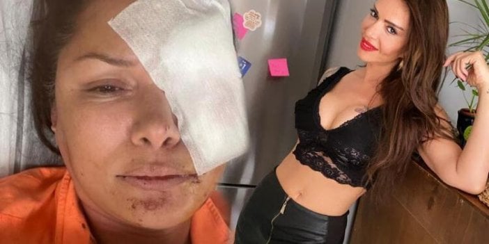 Sevda Demirel'den şok Tuğba Altıntop iddiası: Köpek saldırmamıştır, hemcinsinden şiddet görmüş