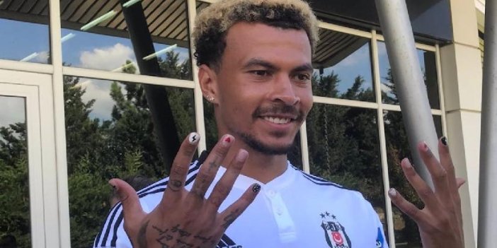 Dele Alli'nin ojeli tırnakları şaşırttı