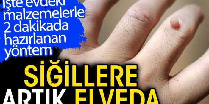 Siğillere artık veda. İşte evdeki malzemelerle 2 dakikada hazırlanan yöntem