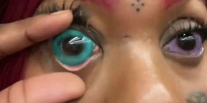Göz bebeklerine mavi dövme yaptırdı. Hayatının kabusunu yaşadı